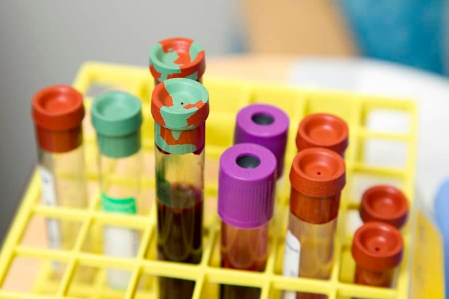 Capped laboratory sample tubes standing in a yellow rack